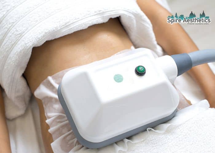 Shift Those Extra Pounds: How Fat Freezing Can Help You Slim Down Felixstowe