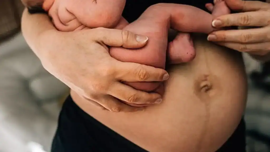 Why Is My Stomach Still Big After Pregnancy Felixstowe?